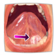 Erkrankungen im Mund, medizinische Illustrationen