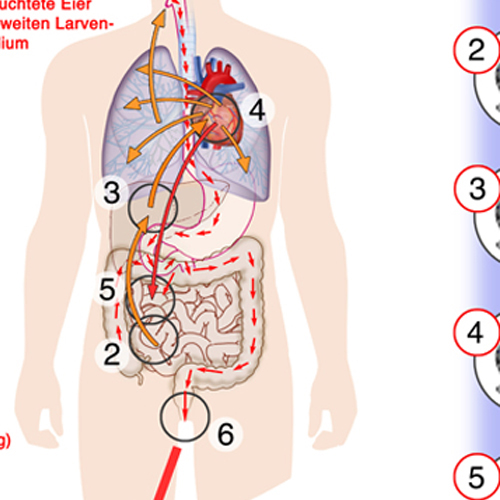 Parasiten, Ascaris lumbricoides: Schema zum Infektionsablauf , medizinische Illustrationen