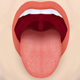 Zunge blecken, Illustrationen für den medizinischen Bereich
